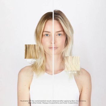 Before After Emma Front