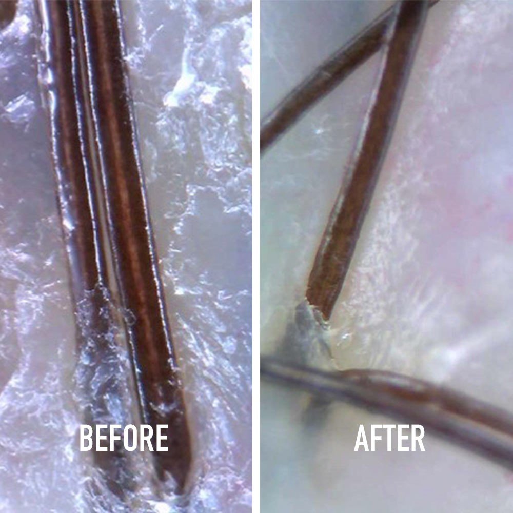 Esfoliante capilar antes e depois